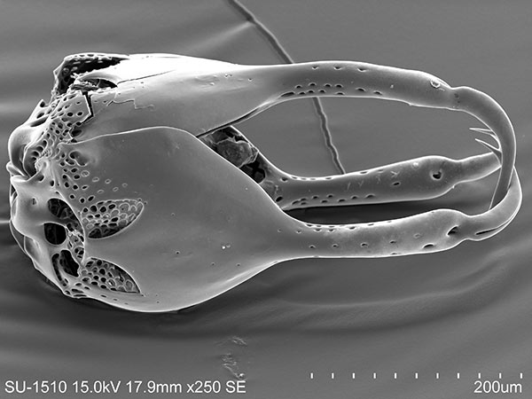 白棘三列海膽反口面紫色球形叉棘SEM照片，側面觀，放大250x。