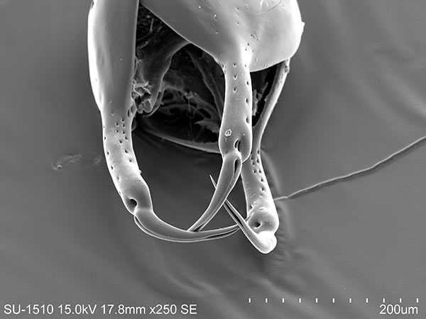 白棘三列海膽反口面紫色球形叉棘SEM照片，頂端中空毒牙，放大250x。